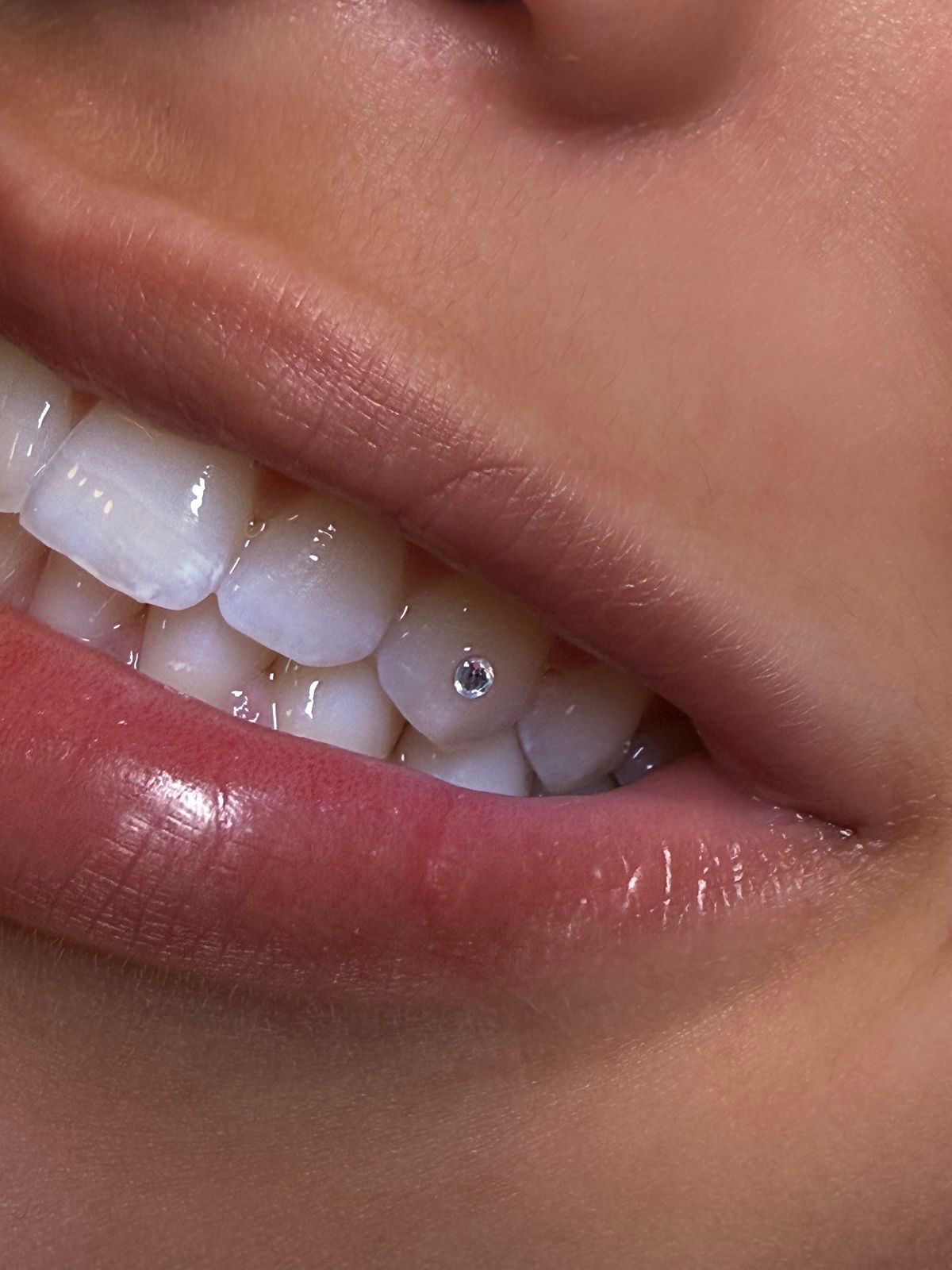 Tooth gems tandjuwelen bij L'éclat Beauté Capelle aan den IJssel